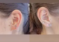 【NEW】耳つぼジュエリー10粒まで3,000→2,500 ネイルとセットで2,200円