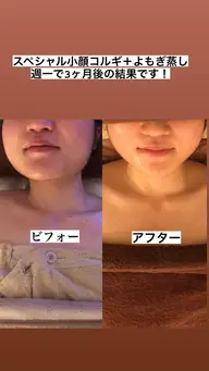 ミニモ学割🌸持続力No. 1【猫背もしっかり解消】上半身マッサージ+小顔コルギ+表情筋引上げEMS 80分