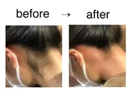 【絶対オススメ！】うなじWAX