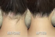 【1回で実感◎施術人数4万人突破記念✨】うなじ脱毛シェービング付◎首元すっきり首長美人✨初回¥4,500