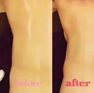 キャビテーション➕ラジオ派