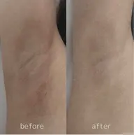 ROMA PINK 脇 モニター定価より40%OFF