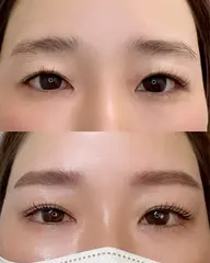 アイブロウ+ワックス脱毛