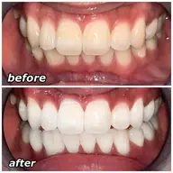 体型×口元 30分で"印象"変えたい方/