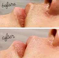 【フェイス全体WAX脱毛+鎮静パック】お仕事帰りOK👩女性限定