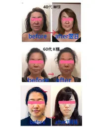 痛くない小顔矯正【初回限定お試し】左右差・歪み・たるみなど深いお悩みにも対応（定価12,000円）小顔マッサージ