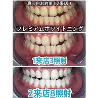 【人気No.1】プレミアムコース❣合計 8回 2 来店（1回10分照射）❣ジェル代別途