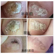 フット巻いたお爪などのケア5500円