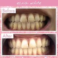 【平日限定/14:30までに入店の方】セルフホワイトニング(9分2セット)１回￥500 別途料金無