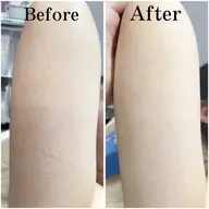 🩵腕半分シェービング(肩～肘or肘から指先)