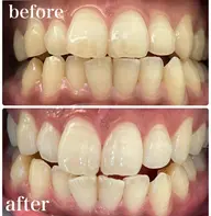 Ｃコース（12回）