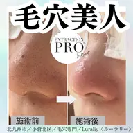 毛穴美人コース