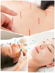 リピート率No.1🌟体質改善・美容鍼💙肌の悩みに合わせて体の鍼を施術、根本から改善したい方におすすめ✨