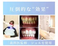 セルフホワイトニング🦷✨