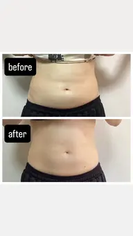 《お腹スッキリ🌱》【便秘・冷え・肌荒れ・ストレスに】やさしく整える腸もみケア60分（問診込み）¥4500