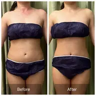 【ビフォアフ撮影可能な方】腸もみ筋膜×痩身✨くびれ引き締めや便秘解消に！30分