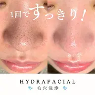 🩷りぴ専用🩷毛穴洗浄〔鼻単品〕🤍