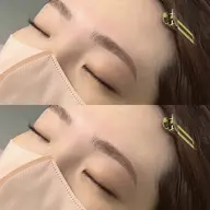 《ハリウッドブロウリフト》