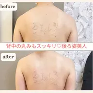 メリハリボディをつくるなら全身筋膜リリース👯‍♀️根本から改善しダイエットしやすい身体へ✨身体もスッキリ軽くなります✨