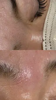 部分ワックス(2カ所のみ)