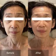 初回スペシャルコース