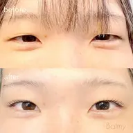 二重サポート！まつげパーマ♪ダブルアイリフト