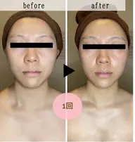 【むくみ｜顔コリ｜疲れ顔】小顔リンパマッサージ※おひとり様1回のみ