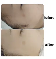 シミ・透明感Upコース