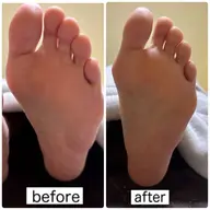 【足裏-15歳😳！？】足裏角質除去ケア