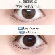 中顔面単純🫧　下まつ毛カール