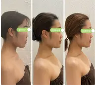 全国にたった6名の認定講師の施術が受けられる!整形級✨頭蓋骨小顔矯正体験