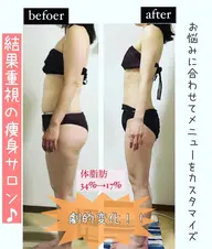 【頑固なセル脂肪撃退!!】とことん痩身カスタマイズ痩せ120分¥10000