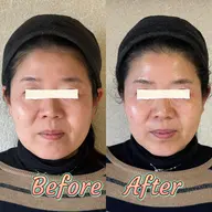 ファーマリジェネ深層美肌コース　50%オフ‼️20000円→10000円