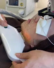 ⚫︎ヒゲ脱毛(保湿パック付き)