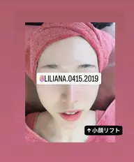 小顔+水光肌仕上げ⭐️ミニモ限定⭐️陶肌トリートメント+小顔筋膜マシーン‼️モデルさんなどもやられているハーブピーリング