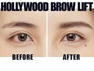 ハリウッドブロウリフト