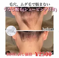 🉐【毛穴/ムダ毛改善】うなじ脱毛 （シェービング付き） ¥4180 → ¥2500