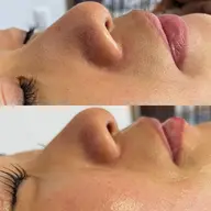 ⭐︎人気No.2⭐︎ラッシュリフト＆フェイシャルWAX