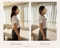 【広尾】むくみ・巻き肩調整｜小顔ケア✖️姿勢バランス調整(症例モニター募集)