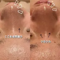 【つるんとスッキリ肌】乾燥・毛穴の黒ずみ・透明感ケア