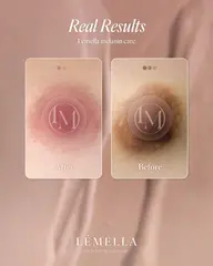 最新メラニンケア 乳輪