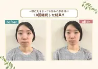 ≪グーグル口コミ投稿お約束価格≫ 小顔矯正と骨盤矯正60分 7600円→0円