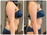 寝てるだけで-〇センチ！？セル脂肪痩身✨体験1回のみ