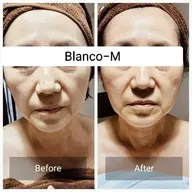 New✨完全リフトアップフェイシャルコース+全身アロマトリートメントの120分コースです🧖🏻💆🏻🦵🏻🙌🏻