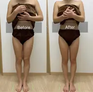 痩身エステ〔半身コース〕