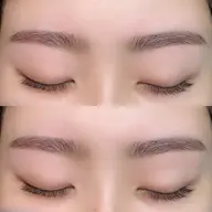 アイブロウ脱毛