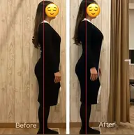 リピートNo.①【小顔矯正✖️美容全身矯正】整骨院生まれ美容矯正!重心バランスを足裏から首/頭蓋骨/顔パーツ整えます⭕️