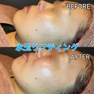 🇰🇷韓国で大人気🇰🇷水玉リフティング🫧赤ちゃんのようなふわふわお肌に👼