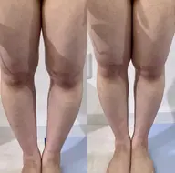 女性限定🍀【全身骨格筋膜リリース＋小顔矯正】全身オイルトリートメント✨フェイシャル/むくみ/痩身エステ/小顔マッサージ