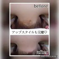 うなじ(もみあげ込)